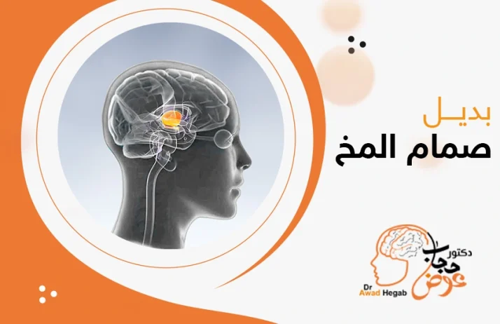 بديل صمام المخ