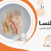 علاج عرق النسا في الرجل اليمنى