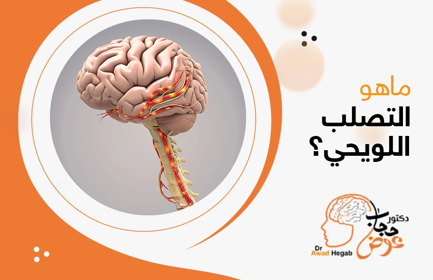 ما هو التصلب اللويحي؟